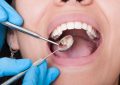 BARREAL CALINGASTA:  Semana del cuidado de la salud bucal
